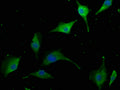 Immunofluorescence staining of U251 cells with CSB-PA839294LA01HU at 1:50, counter-stained with DAPI. The cells were fixed in 4% formaldehyde, permeabilized using 0.2% Triton X-100 and blocked in 10% normal Goat Serum. The cells were then incubated with the antibody overnight at 4°C. The secondary antibody was Alexa Fluor 488-congugated AffiniPure Goat Anti-Rabbit IgG(H+L).
