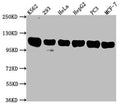 Western Blot
Positive WB detected in: K562 whole cell lysate, 293 whole cell lysate, Hela whole cell lysate, HepG2 whole cell lysate, PC3 whole cell lysate, MCF-7 whole cell lysate
All lanes: ITCH antibody at 1:2000
Secondary
Goat polyclonal to rabbit IgG at 1/50000 dilution
Predicted band size: 103, 99, 87 kDa
Observed band size: 103 kDa