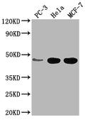 Western Blot
Positive WB detected in: PC-3 whole cell lysate, Hela whole cell lysate, MCF-7 whole cell lysate
All lanes: CCDC74B antibody at 1:2000
Secondary
Goat polyclonal to rabbit IgG at 1/50000 dilution
Predicted band size: 42, 36 kDa
Observed band size: 42 kDa