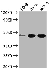 Western Blot
Positive WB detected in: PC-3 whole cell lysate, Hela whole cell lysate, MCF-7 whole cell lysate
All lanes: CCDC74B antibody at 1:2000
Secondary
Goat polyclonal to rabbit IgG at 1/50000 dilution
Predicted band size: 42, 36 kDa
Observed band size: 42 kDa