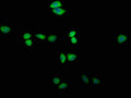 Immunofluorescence staining of Hela cells with CSB-PA839379LA01HU at 1:200, counter-stained with DAPI. The cells were fixed in 4% formaldehyde and blocked in 10% normal Goat Serum. The cells were then incubated with the antibody overnight at 4°C. The secondary antibody was Alexa Fluor 488-congugated AffiniPure Goat Anti-Rabbit IgG(H+L).