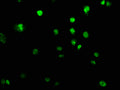 Immunofluorescence staining of U251 cells with CSB-PA839395LA01HU at 1:100, counter-stained with DAPI. The cells were fixed in 4% formaldehyde, permeabilized using 0.2% Triton X-100 and blocked in 10% normal Goat Serum. The cells were then incubated with the antibody overnight at 4°C. The secondary antibody was Alexa Fluor 488-congugated AffiniPure Goat Anti-Rabbit IgG(H+L).