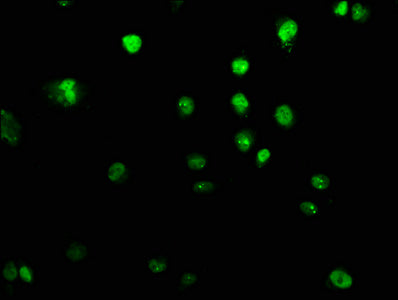 Immunofluorescence staining of U251 cells with CSB-PA839395LA01HU at 1:100, counter-stained with DAPI. The cells were fixed in 4% formaldehyde, permeabilized using 0.2% Triton X-100 and blocked in 10% normal Goat Serum. The cells were then incubated with the antibody overnight at 4°C. The secondary antibody was Alexa Fluor 488-congugated AffiniPure Goat Anti-Rabbit IgG(H+L).
