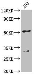 Western Blot
Positive WB detected in: 293 whole cell lysate
All lanes: FIZ1 antibody at 4.5µg/ml
Secondary
Goat polyclonal to rabbit IgG at 1/50000 dilution
Predicted band size: 52 kDa
Observed band size: 52 kDa