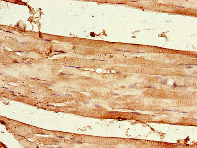 Immunohistochemistry of paraffin-embedded human skeletal muscle tissue using CSB-PA839774LA01HU at dilution of 1:100