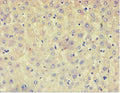 Immunohistochemistry of paraffin-embedded human liver tissue using CSB-PA839800ESR2HU at dilution of 1: 100