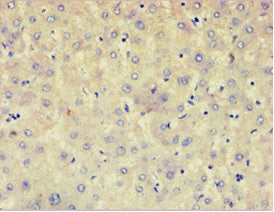 Immunohistochemistry of paraffin-embedded human liver tissue using CSB-PA839800ESR2HU at dilution of 1: 100