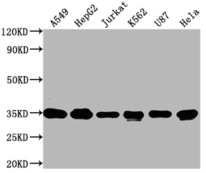 Western Blot
Positive WB detected in: A549 whole cell lysate, HepG2 whole cell lysate, Jurkat whole cell lysate, K562 whole cell lysate, U87 whole cell lysate, Hela whole cell lysate
All lanes: SUMF2 antibody at 1:2000
Secondary
Goat polyclonal to rabbit IgG at 1/50000 dilution
Predicted band size: 34, 25, 38, 24, 35 kDa
Observed band size: 34 kDa