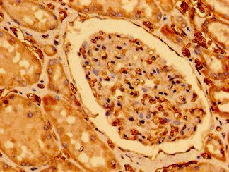Immunohistochemistry of paraffin-embedded human kidney tissue using CSB-PA839862LA01HU at dilution of 1:100