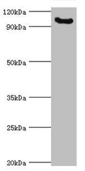 Western blot
All lanes: Microcephalin antibody at 3ug/ml + Mouse liver tissue
Secondary
Goat polyclonal to rabbit IgG at 1/10000 dilution
Predicted band size: 93, 63, 68 kDa
Observed band size: 93 kDa