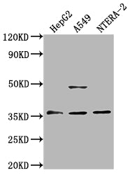 Western Blot
Positive WB detected in: HepG2 whole cell lysate, A549 whole cell lysate, NTERA-2 whole cell lysate
All lanes: OR4D10 antibody at 1:2000
Secondary
Goat polyclonal to rabbit IgG at 1/50000 dilution
Predicted band size: 36 kDa
Observed band size: 36 kDa