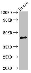 Western Blot
Positive WB detected in: Mouse brain tissue
All lanes: UHMK1 antibody at 3ug/ml
Secondary
Goat polyclonal to rabbit IgG at 1/50000 dilution
Predicted band size: 47, 39, 40 kDa
Observed band size: 47 kDa