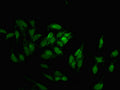 Immunofluorescent analysis of Hela cells using CSB-PA840576LA01HU at dilution of 1:100 and Alexa Fluor 488-congugated AffiniPure Goat Anti-Rabbit IgG(H+L)