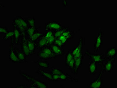 Immunofluorescent analysis of Hela cells using CSB-PA840576LA01HU at dilution of 1:100 and Alexa Fluor 488-congugated AffiniPure Goat Anti-Rabbit IgG(H+L)