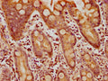 IHC image of CSB-PA840991LA01HU diluted at 1:400 and staining in paraffin-embedded human small intestine tissue performed on a Leica BondTM system. After dewaxing and hydration, antigen retrieval was mediated by high pressure in a citrate buffer (pH 6.0). Section was blocked with 10% normal goat serum 30min at RT. Then primary antibody (1% BSA) was incubated at 4°C overnight. The primary is detected by a biotinylated secondary antibody and visualized using an HRP conjugated SP system.