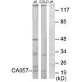 Western blot analysis of extracts from Jurkat cells and COLO205 cells, using CA057 antibody.