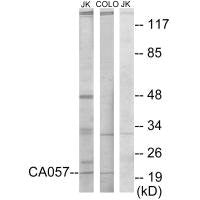 Western blot analysis of extracts from Jurkat cells and COLO205 cells, using CA057 antibody.