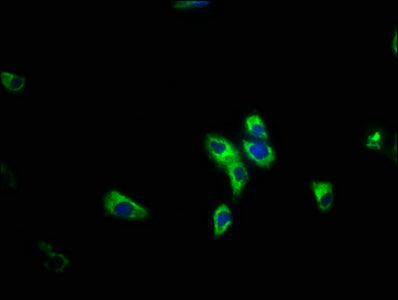 Immunofluorescence staining of HepG2 cells with CSB-PA841225LA01HU at 1:200, counter-stained with DAPI. The cells were fixed in 4% formaldehyde, permeabilized using 0.2% Triton X-100 and blocked in 10% normal Goat Serum. The cells were then incubated with the antibody overnight at 4&deg;C. The secondary antibody was Alexa Fluor 488-congugated AffiniPure Goat Anti-Rabbit IgG(H+L).