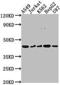 Western Blot
Positive WB detected in: A549 whole cell lysate, Jurkat whole cell lysate, K562 whole cell lysate, HepG2 whole cell lysate, U87 whole cell lysate
All lanes: DNASE2B antibody at 1:2000
Secondary
Goat polyclonal to rabbit IgG at 1/50000 dilution
Predicted band size: 42, 18 kDa
Observed band size: 42 kDa