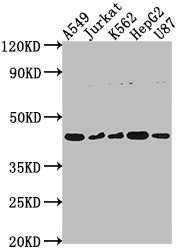 Western Blot
Positive WB detected in: A549 whole cell lysate, Jurkat whole cell lysate, K562 whole cell lysate, HepG2 whole cell lysate, U87 whole cell lysate
All lanes: DNASE2B antibody at 1:2000
Secondary
Goat polyclonal to rabbit IgG at 1/50000 dilution
Predicted band size: 42, 18 kDa
Observed band size: 42 kDa