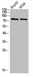 Western Blot analysis of hepg2, NT28 cells using Antibody diluted at 500. Secondary antibody  was diluted at 1:20000