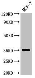 Western Blot
Positive WB detected in: MCF-7 whole cell lysate
All lanes: ACY3 antibody at 3ug/ml
Secondary
Goat polyclonal to rabbit IgG at 1/50000 dilution
Predicted band size: 36 kDa
Observed band size: 36 kDa