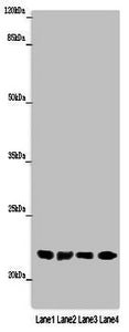 Western blot
All lanes: ABHD14B antibody at 16µg/ml
Lane 1: Mouse small intestine tissue
Lane 2: Mouse spleen tissue
Lane 3: Mouse liver tissue
Lane 4: Mouse lung tissue
Secondary
Goat polyclonal to rabbit IgG at 1/10000 dilution
Predicted band size: 23, 19 kDa
Observed band size: 23 kDa