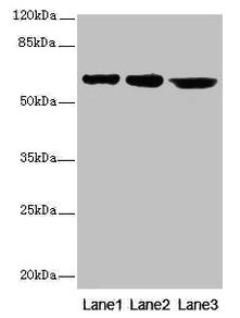 Western blot
All lanes: CATSPER2 antibody at 4µg/ml
Lane 1: Jurkat whole cell lysate
Lane 2: HepG2 whole cell lysate
Lane 3: 293T whole cell lysate
Secondary
Goat polyclonal to rabbit IgG at 1/10000 dilution
Predicted band size: 63, 62, 49, 24 kDa
Observed band size: 63 kDa
