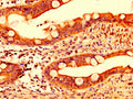 IHC image of CSB-PA842733LA01HU diluted at 1:500 and staining in paraffin-embedded human small intestine tissue performed on a Leica BondTM system. After dewaxing and hydration, antigen retrieval was mediated by high pressure in a citrate buffer (pH 6.0). Section was blocked with 10% normal goat serum 30min at RT. Then primary antibody (1% BSA) was incubated at 4&deg;C overnight. The primary is detected by a biotinylated secondary antibody and visualized using an HRP conjugated SP system.