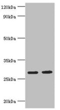 Western blot
All lanes: Ubiquitin-conjugating enzyme E2 J2 antibody at 5ug/ml
Lane 1: HepG2 whole cell lysate
Lane 2: Rat small intestine tissue
Secondary
Goat polyclonal to rabbit IgG at 1/10000 dilution
Predicted band size: 29, 25, 31 kDa
Observed band size: 29 kDa