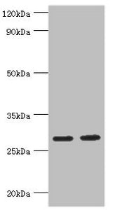 Western blot
All lanes: Ubiquitin-conjugating enzyme E2 J2 antibody at 5ug/ml
Lane 1: HepG2 whole cell lysate
Lane 2: Rat small intestine tissue
Secondary
Goat polyclonal to rabbit IgG at 1/10000 dilution
Predicted band size: 29, 25, 31 kDa
Observed band size: 29 kDa