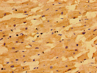Immunohistochemistry of paraffin-embedded human heart tissue using CSB-PA843155LA01HU at dilution of 1:100