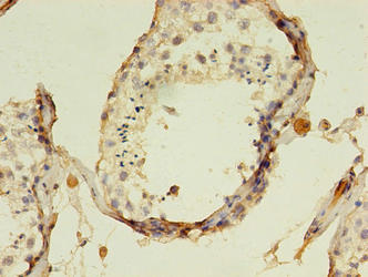 Immunohistochemistry of paraffin-embedded human testis tissue using CSB-PA843276LA01HU at dilution of 1:100