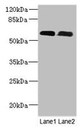 Western Blot
All lanes: PNPLA1 antibody at 12ug/ml
Lane 1: Mouse spleen tissue
Lane 2: Mouse skeletal muscle tissue
Secondary
Goat polyclonal to rabbit IgG at 1/10000 dilution
Predicted band size: 58, 48, 49 kDa
Observed band size: 58 kDa