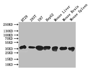 Western Blot
Positive WB detected in: HT29 whole cell lysate, 293T whole cell lysate, U87 whole cell lysate, HepG2 whole cell lysate, Mouse Liver tissue lysate, Mouse Brain tissue lysate, Mouse Spleen tissue lysate
All lanes: SLC10A2 antibody at 1:1000
Secondary
Goat polyclonal to rabbit IgG at 1/50000 dilution
Predicted band size: 38 kDa
Observed band size: 38 kDa