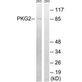 Western blot analysis of extracts from 293 cells, treated with anisomycin (25ug/ml, 30mins), using PKG2 (Ab-126) antibody.