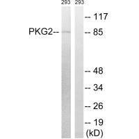 Western blot analysis of extracts from 293 cells, treated with anisomycin (25ug/ml, 30mins), using PKG2 (Ab-126) antibody.