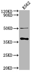 Western Blot
Positive WB detected in: K562 whole cell lysate
All lanes: OR5R1 antibody at 1:2000
Secondary
Goat polyclonal to rabbit IgG at 1/50000 dilution
Predicted band size: 37 kDa
Observed band size: 37 kDa