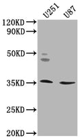 Western Blot
Positive WB detected in: U251 whole cell lysate, U87 whole cell lysate
All lanes: OR5K2 antibody at 1:2000
Secondary
Goat polyclonal to rabbit IgG at 1/50000 dilution
Predicted band size: 36 kDa
Observed band size: 36 kDa