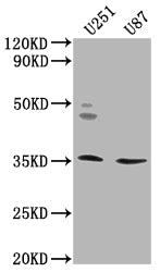 Western Blot
Positive WB detected in: U251 whole cell lysate, U87 whole cell lysate
All lanes: OR5K2 antibody at 1:2000
Secondary
Goat polyclonal to rabbit IgG at 1/50000 dilution
Predicted band size: 36 kDa
Observed band size: 36 kDa