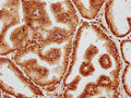 IHC image of CSB-PA844090LA01HU diluted at 1:400 and staining in paraffin-embedded human prostate tissue performed on a Leica BondTM system. After dewaxing and hydration, antigen retrieval was mediated by high pressure in a citrate buffer (pH 6.0). Section was blocked with 10% normal goat serum 30min at RT. Then primary antibody (1% BSA) was incubated at 4&deg;C overnight. The primary is detected by a biotinylated secondary antibody and visualized using an HRP conjugated SP system.