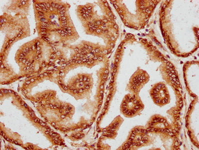 IHC image of CSB-PA844090LA01HU diluted at 1:400 and staining in paraffin-embedded human prostate tissue performed on a Leica BondTM system. After dewaxing and hydration, antigen retrieval was mediated by high pressure in a citrate buffer (pH 6.0). Section was blocked with 10% normal goat serum 30min at RT. Then primary antibody (1% BSA) was incubated at 4&deg;C overnight. The primary is detected by a biotinylated secondary antibody and visualized using an HRP conjugated SP system.