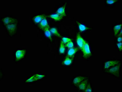 Immunofluorescence staining of Hela cells with CSB-PA844721LA01HU at 1:133, counter-stained with DAPI. The cells were fixed in 4% formaldehyde, permeabilized using 0.2% Triton X-100 and blocked in 10% normal Goat Serum. The cells were then incubated with the antibody overnight at 4°C. The secondary antibody was Alexa Fluor 488-congugated AffiniPure Goat Anti-Rabbit IgG(H+L).