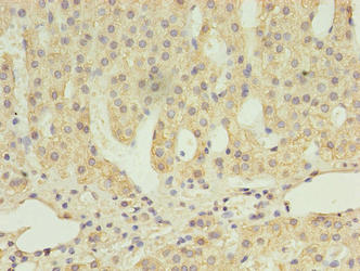 Immunohistochemistry of paraffin-embedded human adrenal gland tissue using CSB-PA845139LA01HU at dilution of 1:100