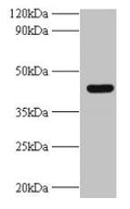 Western blot
All lanes: UBE2Q2 antibody at 2µg/ml + A431 whole cell lysate
Secondary
Goat polyclonal to rabbit IgG at 1/10000 dilution
Predicted band size: 43, 37, 41, 39 kDa
Observed band size: 43 kDa