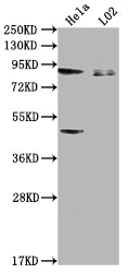 Western Blot
Positive WB detected in: Hela whole cell lysate, L02 whole cell lysate
All lanes: PIBF1 antibody at 1:2000
Secondary
Goat polyclonal to rabbit IgG at 1/50000 dilution
Predicted band size: 90, 26, 13, 36 kDa
Observed band size: 90 kDa