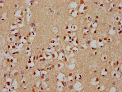 IHC image of CSB-PA846293LA01HU diluted at 1:400 and staining in paraffin-embedded human brain tissue performed on a Leica BondTM system. After dewaxing and hydration, antigen retrieval was mediated by high pressure in a citrate buffer (pH 6.0). Section was blocked with 10% normal goat serum 30min at RT. Then primary antibody (1% BSA) was incubated at 4°C overnight. The primary is detected by a biotinylated secondary antibody and visualized using an HRP conjugated SP system.