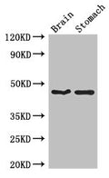 Western Blot
Positive WB detected in: Mouse brain tissue, Mouse stomach tissue
All lanes: TBC1D20 antibody at 4ug/ml
Secondary
Goat polyclonal to rabbit IgG at 1/50000 dilution
Predicted band size: 46, 20, 49 kDa
Observed band size: 46 kDa