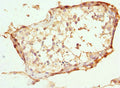 Immunohistochemistry of paraffin-embedded human testis tissue using CSB-PA846641ESR1HU at dilution of 1:100