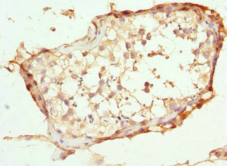 Immunohistochemistry of paraffin-embedded human testis tissue using CSB-PA846641ESR1HU at dilution of 1:100